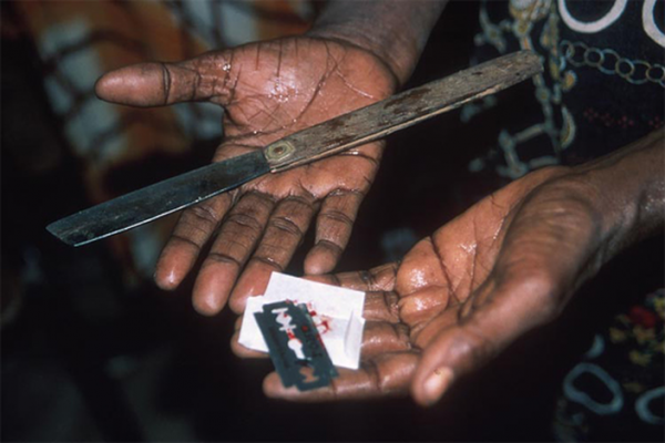 女性割禮極殘忍 逾1.5億婦女受罪